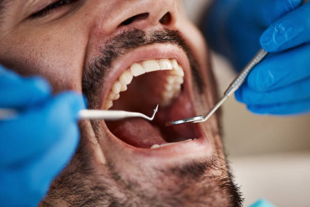 Best Broken or Chipped Tooth Repair in Pottsboro, TX