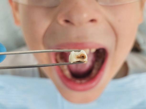 Best Emergency Orthodontic Repairs in Pottsboro, TX